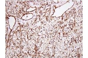 Immunohistochemistry (IHC) image for anti-Clusterin (CLU) (AA 1-333), (N-Term) antibody (ABIN317504) (Clusterin antibody  (N-Term))