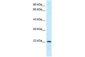 Western Blot showing Guk1 antibody used at a concentration of 1.