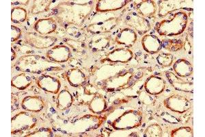 Immunohistochemistry of paraffin-embedded human kidney tissue using ABIN7155305 at dilution of 1:100 (HDAC1 antibody  (AA 207-412))