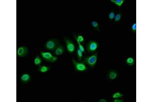 Immunofluorescence staining of HepG2 cells with ABIN7172938 at 1:133, counter-stained with DAPI. (TM6SF2 antibody  (AA 290-331))