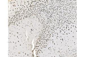 IHC analysis of JUNB using anti-JUNB antibody (ABIN7603223).
