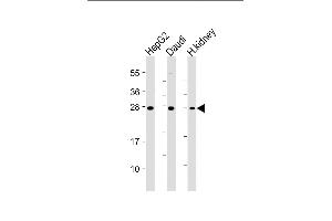 All lanes : Anti-HAVCR2 Antibody at 1:4000 dilution Lane 1: HepG2 whole cell lysate Lane 2: Daudi whole cell lysate Lane 3: Human kidney lysate Lysates/proteins at 20 μg per lane. (TIM3 antibody)