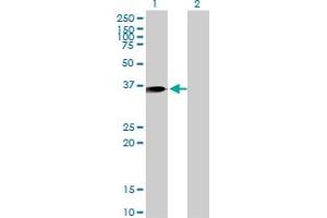 Western Blot analysis of ANXA1 expression in transfected 293T cell line by ANXA1 monoclonal antibody (M10), clone 2D11. (Annexin a1 antibody  (AA 1-346))