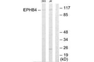 Western Blotting (WB) image for anti-EPH Receptor B4 (EPHB4) (AA 571-620) antibody (ABIN2889520) (EPH Receptor B4 antibody  (AA 571-620))