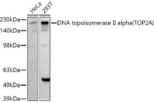 Western blot analysis of extracts of various cell lines, using DNA topoisomerase II alpha (TOP2A) antibody (ABIN7270853) at 1:1000 dilution. (Topoisomerase II alpha antibody  (AA 1050-1150))