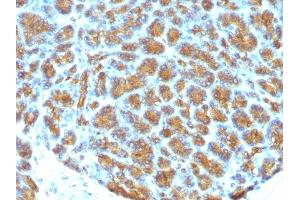 Immunohistochemistry (IHC) image for anti-Milk Fat Globule-EGF Factor 8 Protein (MFGE8) antibody (ABIN6940033)