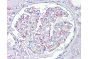 Image no. 1 for anti-Mesothelin (MSLN) (AA 395-444) antibody (ABIN6741693)