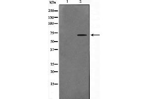 Western blot analysis on A549 cell lysate using CERKL Antibody,The lane on the left is treated with the antigen-specific peptide. (CERKL antibody  (Internal Region))