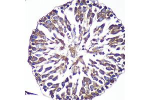 Immunohistochemistry of paraffin-embedded Rat testis using  Rabbit pAb (ABIN7265603) at dilution of 1:100 (40x lens). (ANKLE2 antibody  (AA 350-450))