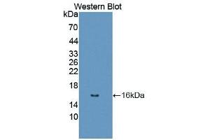 Detection of Recombinant DRD1, Human using Polyclonal Antibody to Dopamine Receptor D1 (DRD1) (Dopamine Receptor d1 antibody  (AA 338-446))