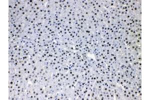 IHC testing of FFPE rat liver tissue with HDGF antibody at 1ug/ml. (HDGF antibody  (AA 61-97))