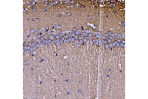 IHC analysis of SH3GL2 using anti-SH3GL2 antibody (ABIN7602229). (SH3G2 antibody  (AA 65-292))