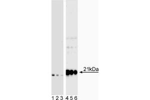 Western blot analysis of CD3z (CD247) (pY142) in human T lymphocytes. (CD247 antibody  (pTyr142))