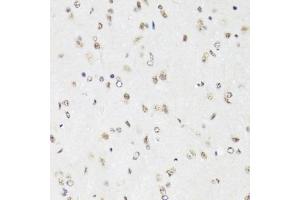 Immunohistochemistry of paraffin-embedded mouse brain using EFTUD2 Antibody (ABIN5974236) at dilution of 1/100 (40x lens). (EFTUD2 antibody)