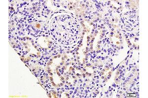 Formalin-fixed and paraffin embedded rat brain labeled with Anti RASSF3 Polyclonal Antibody, Unconjugated (ABIN762101) at 1:200 followed by conjugation to the secondary antibody and DAB staining (RASSF3 antibody  (AA 51-150))