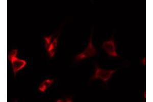 ABIN6274874 staining COLO205 by IF/ICC. (ATP5I antibody  (C-Term))