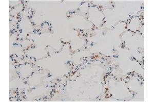 ABIN6267411 at 1/200 staining Rat lung tissue sections by IHC-P. (JunD antibody  (pSer255))