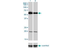 Western Blotting (WB) image for anti-phosphoinositide Kinase, FYVE Finger Containing (PIKFYVE) (AA 342-452) antibody (ABIN599337) (PIKFYVE antibody  (AA 342-452))