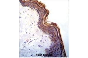 Kallikrein 7(KLK7) Antibody (C-term) (ABIN652198 and ABIN2840744) immunohistochemistry analysis in formalin fixed and paraffin embedded human skin tissue followed by peroxidase conjugation of the secondary antibody and DAB staining. (Kallikrein 7 antibody  (C-Term))
