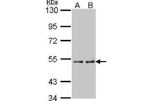 CYP4A11 Antikörper  (Center)
