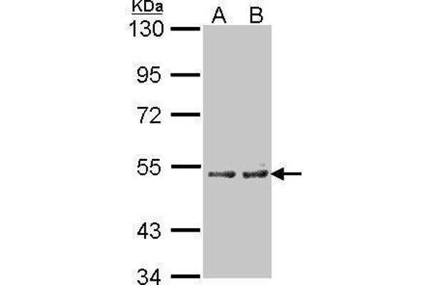CYP4A11 Antikörper  (Center)
