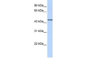 WB Suggested Anti-B3GNT4 Antibody Titration:  0. (B3GNT4 antibody  (N-Term))