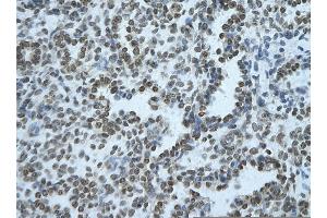 Rabbit Anti-BHLHE40 Antibody       Paraffin Embedded Tissue:  Human alveolar cell   Cellular Data:  Epithelial cells of renal tubule  Antibody Concentration:   4. (BHLHE40 antibody  (Middle Region))