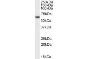 ABIN190813 (1µg/ml) staining of K562 cell lysate (35µg protein in RIPA buffer). (FOXO4 antibody  (Internal Region))