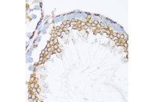 Immunohistochemistry of paraffin-embedded mouse testis using CTNNA1 antibody. (CTNNA1 antibody)