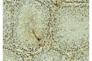ABIN6267614 at 1/100 staining Mouse testis tissue by IHC-P. (PKC zeta antibody  (pThr560))