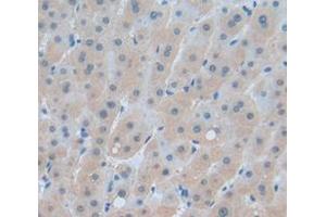 Figure. (NPEPPS antibody  (AA 141-272))