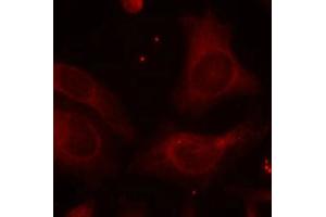 Immunofluorescence staining of methanol-fixed Hela cells using NFkB-p105(Phospho-Ser927) Antibody. (NFKB1 antibody  (pSer927))