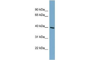 WB Suggested Anti-ST8SIA6 Antibody Titration:  0. (ST8SIA6 antibody  (Middle Region))