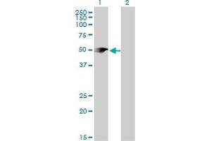 Western Blot analysis of PIP4K2A expression in transfected 293T cell line by PIP4K2A monoclonal antibody (M08), clone 3H5. (PIP4K2A antibody  (AA 1-406))