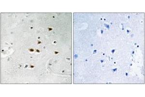 Immunohistochemistry analysis of paraffin-embedded human brain, using ITCH (Phospho-Tyr420) Antibody.