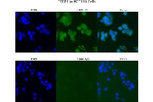 Sample Type :  HCT116   Primary Antibody Dilution:  4 ug/ml   Secondary Antibody :  Anti-rabbit Alexa 546   Secondary Antibody Dilution:  2 ug/ml   Gene Name :  TFDP1 (DP1 antibody  (N-Term))
