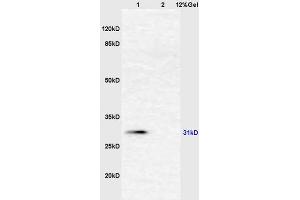 Lane 1: mouse liver lysates Lane 2: mouse intestine lysates probed with Anti AHSG/Fetuin A/Alpha 2 HS Glycoprotein Polyclonal Antibody, Unconjugated (ABIN681733) at 1:200 in 4 °C. (Fetuin A antibody  (AA 201-300))