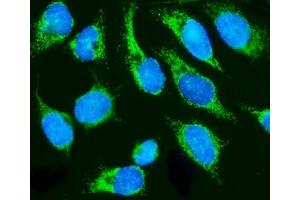 IF analysis of HCCS using anti-HCCS antibody (ABIN7602424). (HCCS antibody  (AA 76-268))