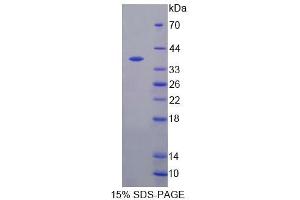 SDS-PAGE analysis of Mouse S17aH Protein.
