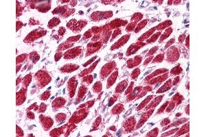 EAP30 antibody was used for immunohistochemistry at a concentration of 4-8 ug/ml.