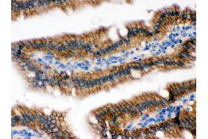 Immunohistochemistry (Paraffin-embedded Sections) (IHC (p)) image for anti-UPF1 Regulator of Nonsense Transcripts Homolog (UPF1) (AA 578-614), (Middle Region) antibody (ABIN3043955)