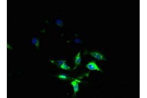 Immunofluorescent analysis of U251 cells using ABIN7153256 at dilution of 1:100 and Alexa Fluor 488-congugated AffiniPure Goat Anti-Rabbit IgG(H+L)
