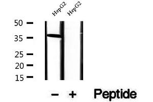 RLBP1 antibody  (Internal Region)