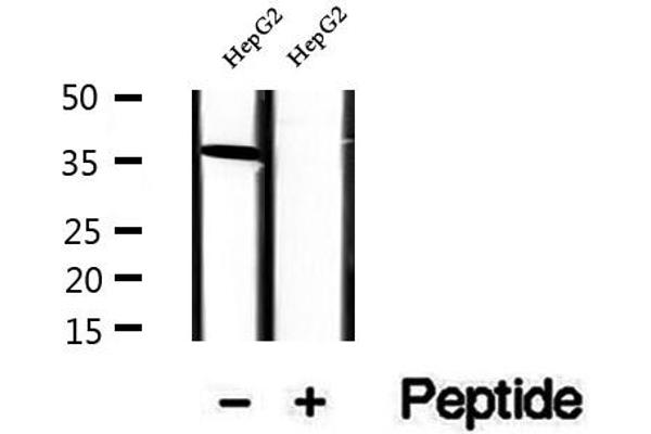 RLBP1 antibody  (Internal Region)