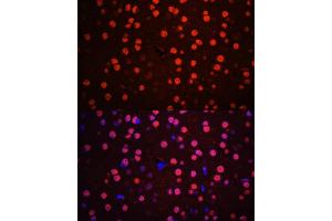 Immunofluorescence analysis of mouse brain using Phospho-p38 MAPK-T180/Y182 antibody (ABIN6135257, ABIN6136138, ABIN6136139 and ABIN6225556) at dilution of 1:100. (MAPK14 antibody  (pThr180, pTyr182))