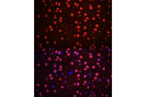 Immunofluorescence analysis of mouse brain using Phospho-p38 MAPK-T180/Y182 antibody (ABIN6135257, ABIN6136138, ABIN6136139 and ABIN6225556) at dilution of 1:100. (MAPK14 antibody  (pThr180, pTyr182))