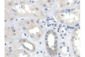 Detection of MTUS1 in Human Kidney Tissue using Polyclonal Antibody to Mitochondrial Tumor Suppressor 1 (MTUS1) (MTUS1 antibody  (AA 1018-1270))