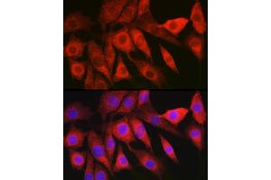 Immunofluorescence analysis of NIH/3T3 cells using L Rabbit pAb (ABIN6130466, ABIN6143085, ABIN6143086 and ABIN6219719) at dilution of 1:200 (40x lens). (HBXIP antibody  (AA 1-173))