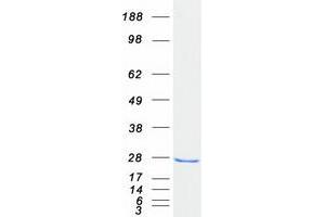 Western Blotting (WB) image for RAB18, Member RAS Oncogene Family (RAB18) protein (Myc-DYKDDDDK Tag) (ABIN2730281)