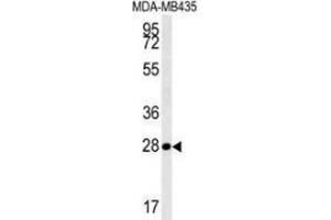 Western blot analysis in MDA-MB435 cell line lysates (35ug/lane) using MRM1 Antibody (N-term). (MRM1 antibody  (N-Term))
